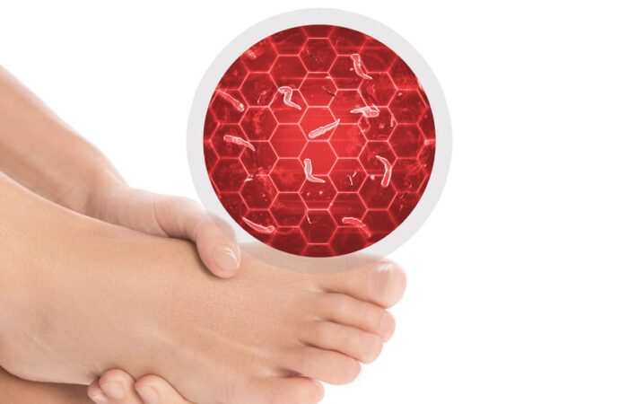 Ako sa zbaviť nepríjemného svrbenia a infekcie na nohách?